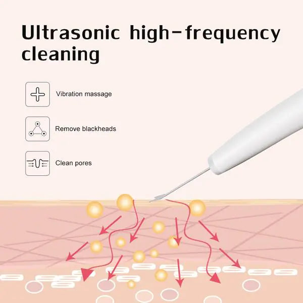 Ultrasonic Skin Scrubber - Facial Exfoliator & Deep Cleansing Device