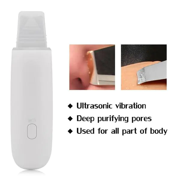 Ultrasonic Skin Scrubber - Facial Exfoliator & Deep Cleansing Device