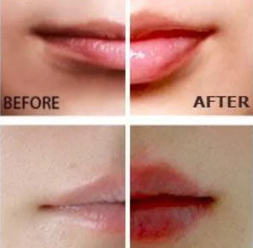 Electric Lip Plumper - Instant Fuller Lips Enhancement Device