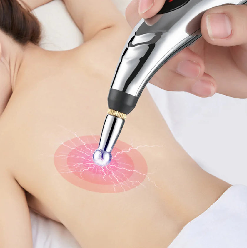 Micro-Electric Acupuncture Pen - Portable Pain Relief & Wellness Device
