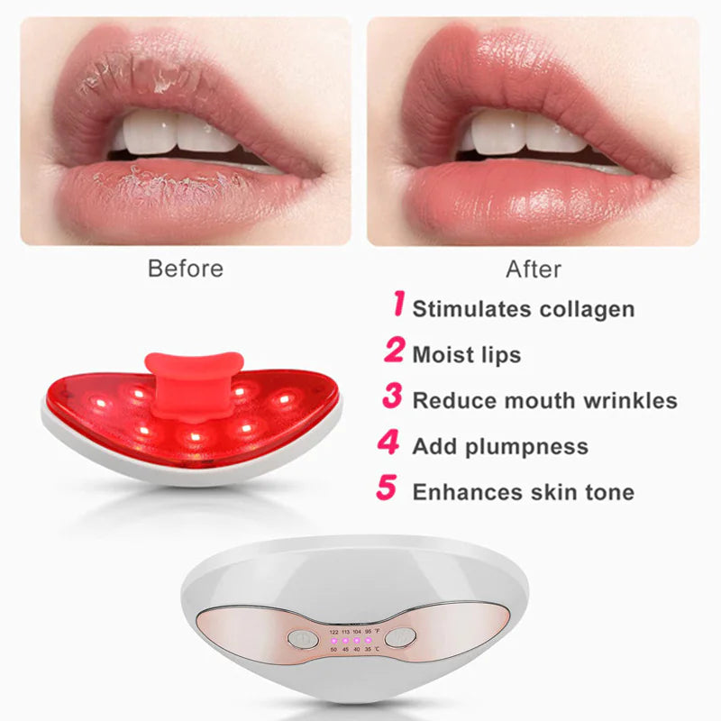 Heated Lip Plumper Device - LED Light Therapy for Fuller Lips